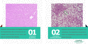 Aspecto microscópico de um fígado normal e com esteatose.